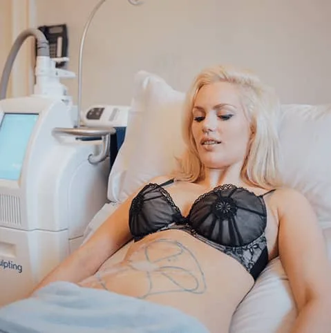Woman on a treatment couch with treatment areas marked on her abdomen at Cool Clinic, CoolSculpting fat freezing Dublin