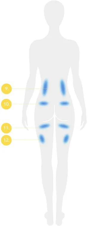 Back body diagram with numbered treatable fat areas for CoolSculpting fat freezing in Dublin